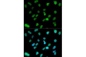 Image no. 1 for anti-Lysine (K)-Specific Demethylase 1A (KDM1A) antibody (ABIN3021575)