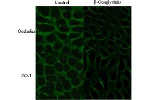 Immunofluorescence (Cultured Cells) (IF (cc)) image for anti-Occludin (OCLN) (AA 431-522) antibody (ABIN687337)