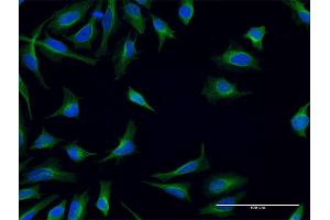 Image no. 3 for anti-Formyl Peptide Receptor 2 (FPR2) (AA 163-205) antibody (ABIN515802)