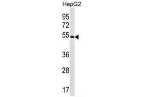 Image no. 2 for anti-Mannosyl (Alpha-1,3-)-Glycoprotein beta-1,4-N-Acetylglucosaminyltransferase, Isozyme C (MGAT4C) (AA 302-332), (C-Term) antibody (ABIN953409)