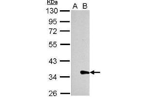 Image no. 1 for anti-Lectin, Galactoside-Binding, Soluble, 8 (LGALS8) (Center) antibody (ABIN2856442)