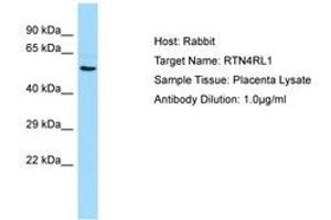 Image no. 1 for anti-Reticulon 4 Receptor-Like 1 (RTN4RL1) (AA 331-380) antibody (ABIN6750227)