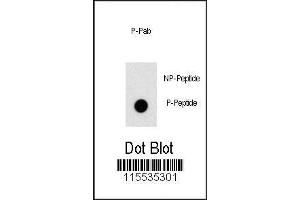 Image no. 1 for anti-Zinc Finger and BTB Domain Containing 16 (ZBTB16) (pTyr334) antibody (ABIN389958)