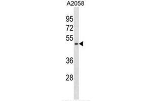 Image no. 1 for anti-Bifunctional Apoptosis Regulator (BFAR) (AA 1-30), (N-Term) antibody (ABIN950658)