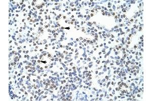 Image no. 2 for anti-Pogo Transposable Element with ZNF Domain (POGZ) (N-Term) antibody (ABIN925917)