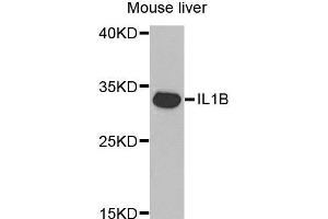 Image no. 2 for anti-Interleukin 1, beta (IL1B) antibody (ABIN3021462)
