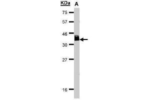 WB Image Sample(30 μg of whole cell lysate) A:HeLa S3, 15% SDS PAGE antibody diluted at 1:1000