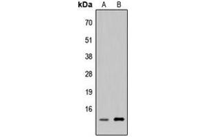 Image no. 2 for anti-Chromosome 5 Open Reading Frame 13 (C5orf13) (Center) antibody (ABIN2706752)