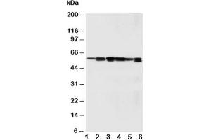 Image no. 2 for anti-Abl-Interactor 1 (ABI1) (C-Term) antibody (ABIN3029824)
