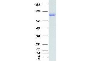 Image no. 1 for Disabled Homolog 2, Mitogen-Responsive phosphoprotein (Drosophila) (DAB2) protein (Myc-DYKDDDDK Tag) (ABIN2712271)