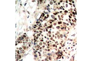 Image no. 1 for anti-Histone Deacetylase 3 (HDAC3) (C-Term), (pSer424) antibody (KLH) (ABIN2972575)