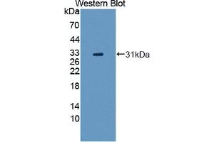 Image no. 1 for anti-Transformation/transcription Domain-Associated Protein (TRRAP) (AA 3534-3770) antibody (ABIN5014439)