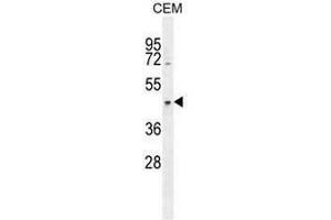 Image no. 1 for anti-Coiled-Coil Domain Containing 122 (CCDC122) (AA 206-235), (C-Term) antibody (ABIN951087)