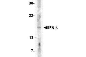 Image no. 1 for anti-Interferon, beta 1, Fibroblast (IFNB1) (Middle Region) antibody (ABIN1030952)