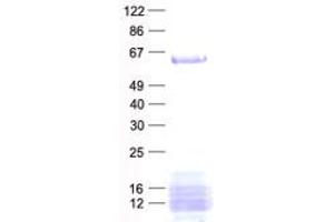 AGFG1 Protein (His tag)