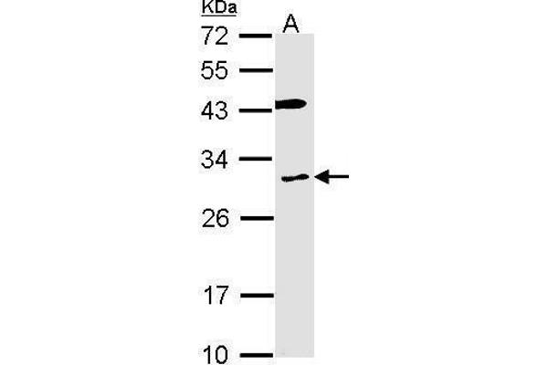 anti-Cytochrome B Reductase 1 (CYBRD1) (C-Term) antibody