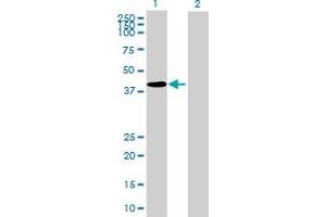 Image no. 3 for anti-Transforming Growth Factor beta 1 Induced Transcript 1 (TGFB1I1) (AA 1-444) antibody (ABIN520871)