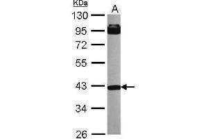 Image no. 1 for anti-Inositol Polyphosphate-5-Phosphatase, 40kDa (INPP5A) (Center) antibody (ABIN2855996)