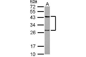 Image no. 1 for anti-Twinfilin, Actin-Binding Protein 1 (TWF1) (AA 14-208) antibody (ABIN1501587)