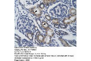 Image no. 1 for anti-Tripartite Motif Containing 68 (TRIM68) (Middle Region) antibody (ABIN2775806)