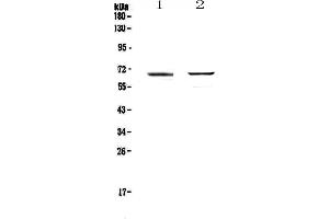 Image no. 3 for anti-Runt-Related Transcription Factor 1, Translocated To, 1 (Cyclin D-Related) (RUNX1T1) (AA 335-510) antibody (ABIN5693284)
