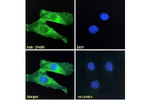 ABIN7013872 Immunofluorescence analysis of paraformaldehyde fixed HeLa cells, permeabilized with 0.