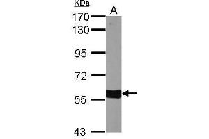 Image no. 5 for anti-Cytochrome P450, Family 27, Subfamily A, Polypeptide 1 (CYP27A1) (Center) antibody (ABIN2855688)