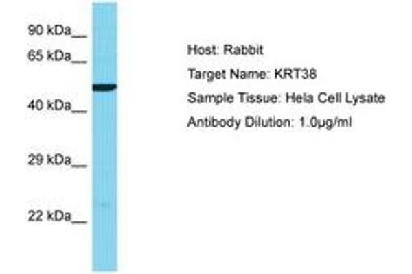 KRT38 Antikörper  (AA 206-255)