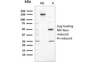 Image no. 4 for anti-Nucleoside diphosphate kinase B (NME2) antibody (ABIN6940215)
