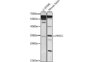 PRRT2 antibody  (AA 20-130)