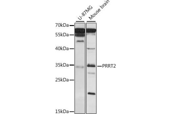 PRRT2 antibody  (AA 20-130)