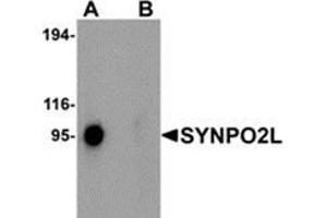 Image no. 1 for anti-Synaptopodin 2-Like (SYNPO2L) (N-Term) antibody (ABIN783777)