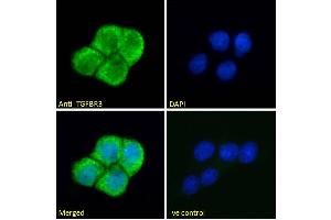 Image no. 1 for anti-Transforming Growth Factor, beta Receptor III (TGFBR3) (Internal Region) antibody (ABIN263177)