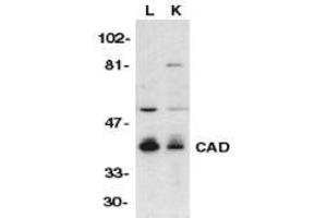 Image no. 1 for anti-DNA Fragmentation Factor, 40kDa, beta Polypeptide (Caspase-Activated DNase) (DFFB) (C-Term) antibody (ABIN499517)