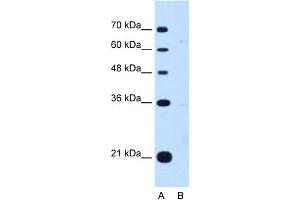 Image no. 1 for anti-Downstream Neighbor of SON (DONSON) (Middle Region) antibody (ABIN2782388)