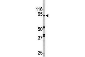 Image no. 4 for anti-Lysine (K)-Specific Demethylase 1A (KDM1A) (AA 108-142) antibody (ABIN3031651)