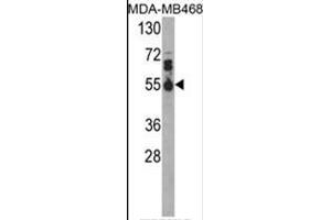 Image no. 1 for anti-Interleukin 17 Receptor B (IL17RB) (Middle Region) antibody (ABIN453128)
