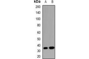 Image no. 2 for anti-Suppressor of Cytokine Signaling 2 (SOCS2) antibody (ABIN3222980)