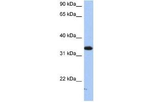 Image no. 1 for anti-Sulfotransferase Family, Cytosolic, 6B, Member 1 (SULT6B1) antibody (ABIN2459206)