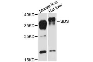 Image no. 1 for anti-serine Dehydratase (SDS) antibody (ABIN6293759)