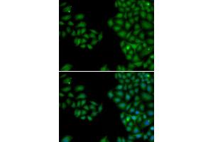 Image no. 2 for anti-Neurofilament, Light Polypeptide (NEFL) antibody (ABIN3020809)
