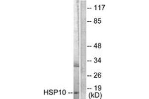 Image no. 1 for anti-Heat Shock 10kDa Protein 1 (Chaperonin 10) (HSPE1) (AA 51-100) antibody (ABIN1533310)