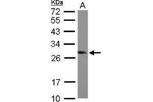 Image no. 2 for anti-Small Nuclear Ribonucleoprotein Polypeptides B and B1 (SNRPB) (Center) antibody (ABIN2855215)