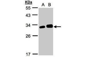 Latexin antibody  (Center)