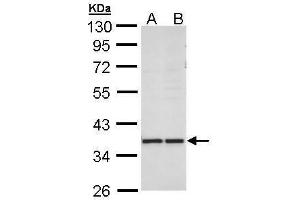 Image no. 4 for anti-Aldo-Keto Reductase Family 1, Member B10 (Aldose Reductase) (AKR1B10) (full length) antibody (ABIN2856687)