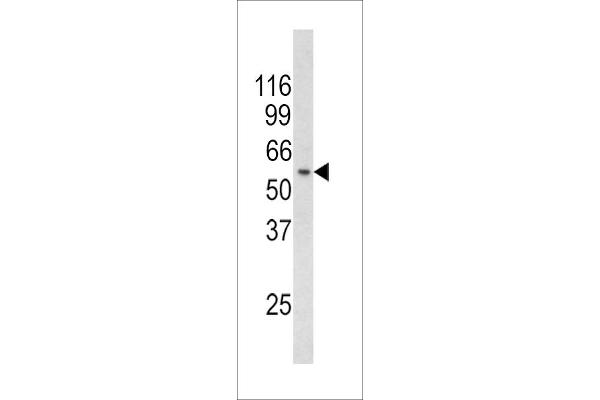 RCBTB2 Antikörper  (N-Term)