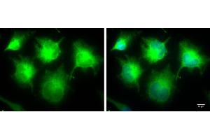 Image no. 2 for anti-Inhibitor of kappa Light Polypeptide Gene Enhancer in B-Cells, Kinase epsilon (IKBKE) (Center) antibody (ABIN2856120)