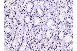 Image no. 2 for anti-Tumor Protein P63 (TP63) (C-Term) antibody (ABIN2682710)