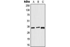 Image no. 2 for anti-ALX Homeobox 3 (ALX3) (Center) antibody (ABIN2705449)
