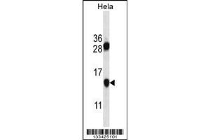 Image no. 1 for anti-PHD Finger Protein 5A (PHF5A) (AA 81-110), (C-Term) antibody (ABIN657423)